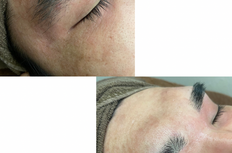 Beige Minimalist Beauty Before After Collage Instagram Post