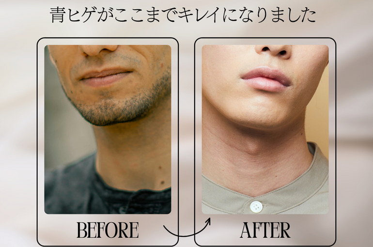 ニュートラル モダン メンズ美容サロン Before After インスタグラムの投稿（45）
