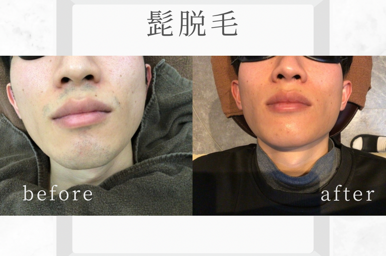 白　グレー　シンプル　モダン　大理石　自己紹介　Instagram投稿正方形
