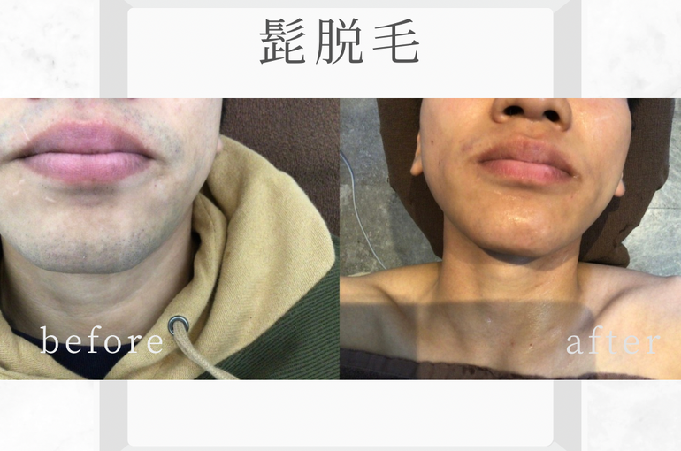 白　グレー　シンプル　モダン　大理石　自己紹介　Instagram投稿正方形